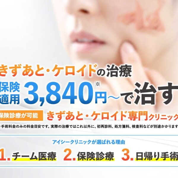 ケロイド・肥厚性瘢痕の専門治療｜アイシークリニック大宮院