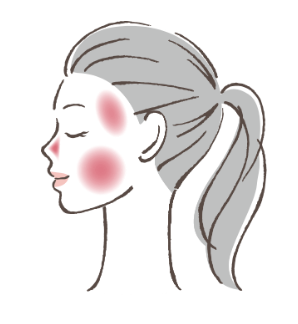 Enrojecimiento facial y rosácea